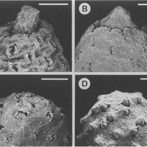 Variation in the structure of the apex of the androecium in Kadsura... | Download Scientific Diagram