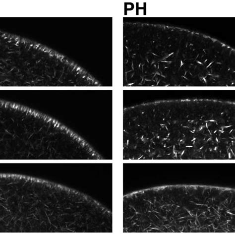 The spikes protruding into the perivitelline space during fertilization... | Download Scientific ...