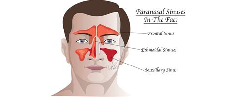 London ENT Associates | Blocked Nose