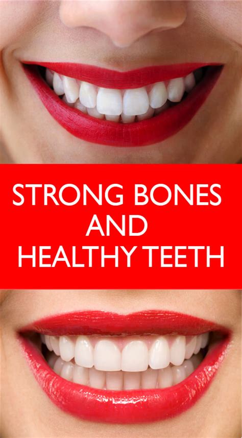 STRONG BONES AND HEALTHY TEETH - herbal medicine