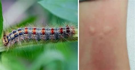 People Are Being Warned About Gypsy Moth Caterpillars And The Terrible Rashes They Cause - Relay ...