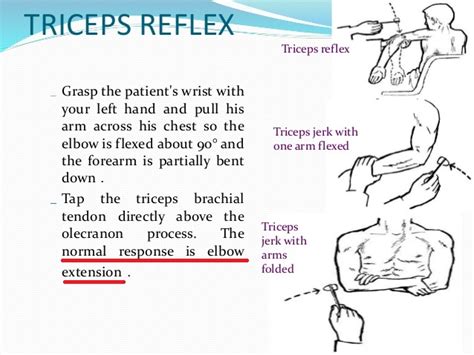 Is the expected response to the triceps-jerk reflex flexion of the ...