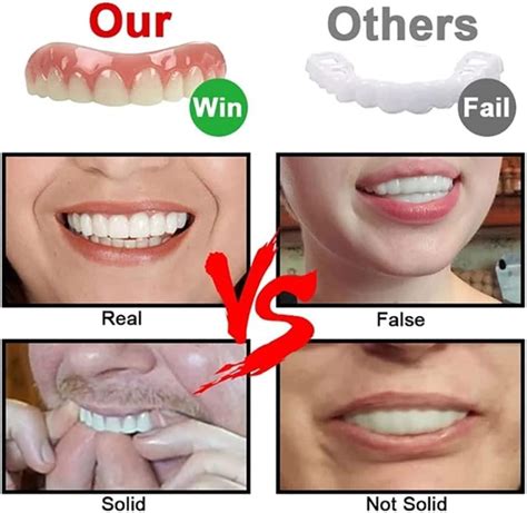 Women's Realistic Veneers Teeth - Upper and Lower Dentures for Missing Teeth