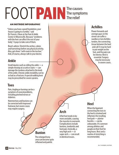 Foot Pain Diagram - exatin.info