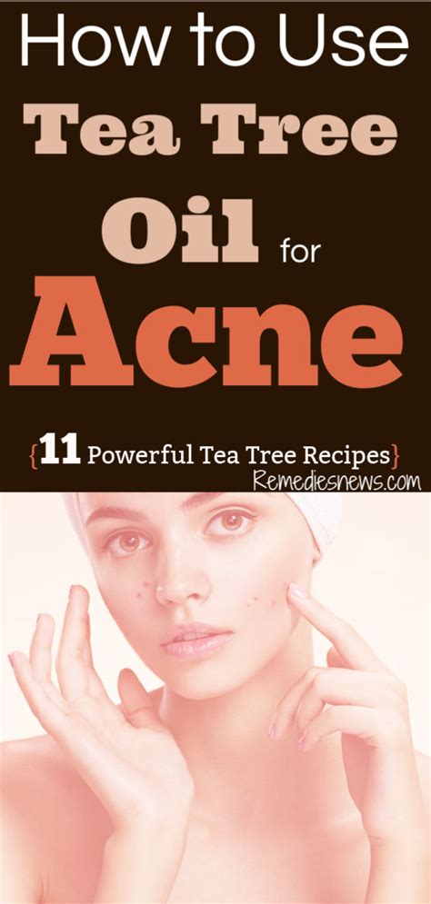 How to Use Tea Tree Oil for Acne : 11 Powerful Tea Tree Oil Recipes