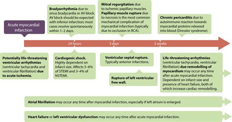 STEMI (ST Elevation Myocardial Infarction): diagnosis, criteria, ECG & management – ECG & ECHO