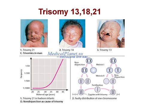 Mengenal Tiga Kelainan Trisomi pada Ibu Hamil (Down, Edward, dan Patau Syndrome)