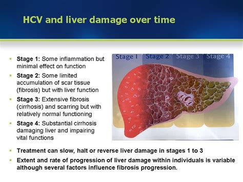 17 Best images about Liver Fibrosis on Pinterest | A well, Disorders and Spanish