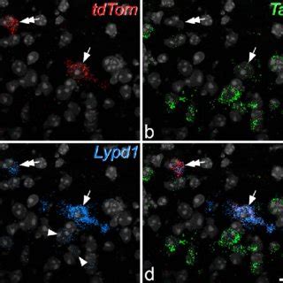 Fluorescence in situ hybridisation with RNAscope in a transverse... | Download Scientific Diagram