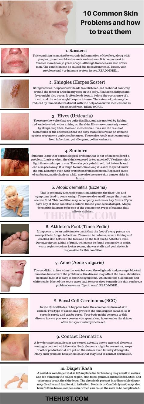 Symptoms Of Common Skin Conditions Every Parent Should Know Photo – Otosection