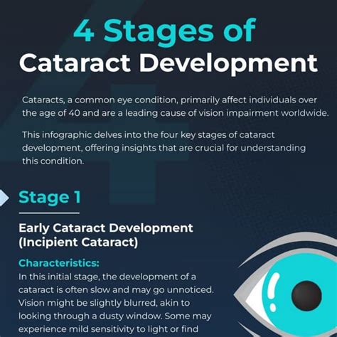 4 Stages of Cataract Development | PDF