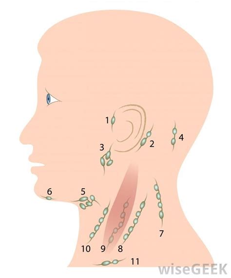 Headache and swollen lymph nodes in neck images | aboutheadache