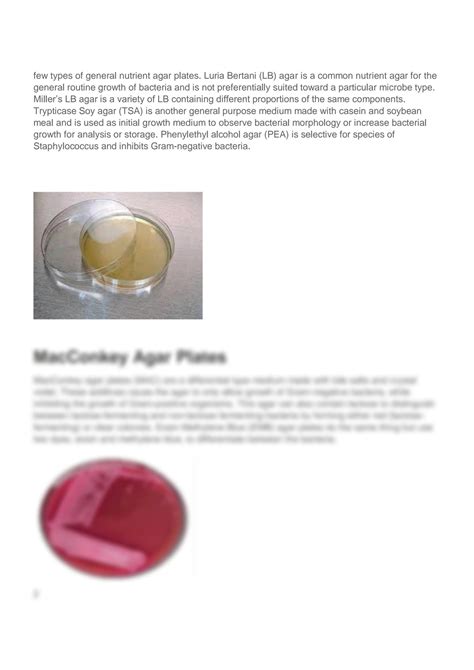 SOLUTION: Types of agar plates - Studypool