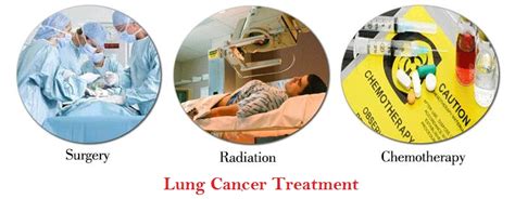 Lung Cancer: Symptoms, Causes, Diagnosis & Treatment » How To Relief