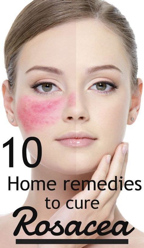 Rosacea is a chronic skin condition that usually affects the face, particularly the forehea ...