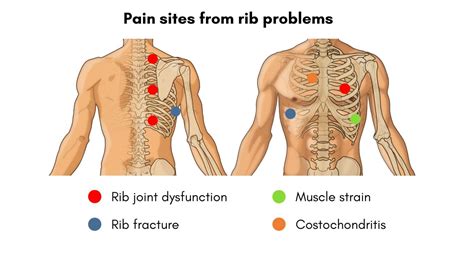 Chest Or Rib Pain? Causes and Solutions - Sundial Clinics