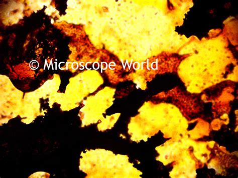 Microscope World Blog: Tuberculosis under the Microscope