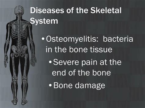 Skeletal System Diseases