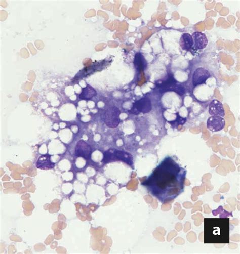 Treatment of hepatic lipidosis in the cat | Vet Focus