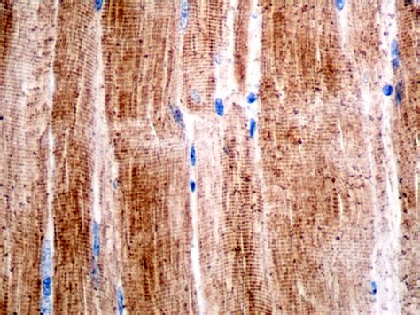 Immunohistochemical Staining Techniques | Histology