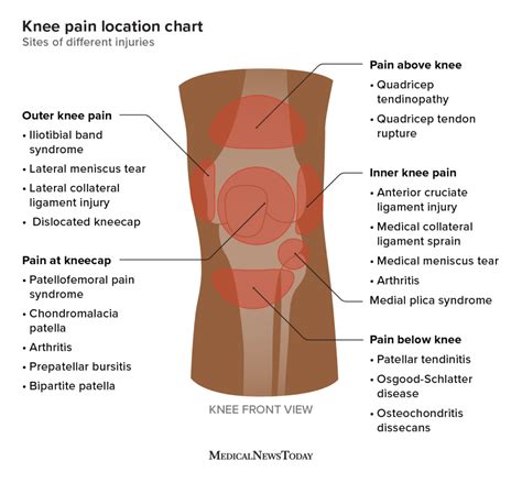 Knee Pain Images