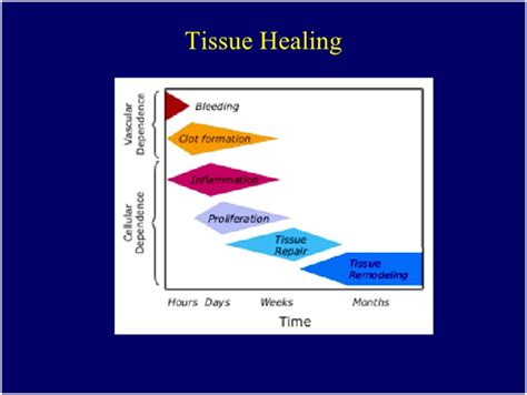 Strains and sprains - Heal Your Injury Strong and Fast - PhysioPrescription