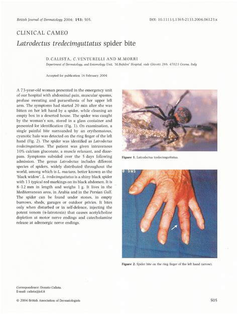 (PDF) Latrodectus tredecimguttatus spider bite