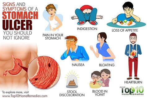 10 Signs and Symptoms of a Stomach Ulcer You Should Not Ignore | Top 10 Home Remedies