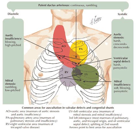 Heart Murmurs and Valvular Diseases - Differential Diagnosis, Examination and Investigations ...