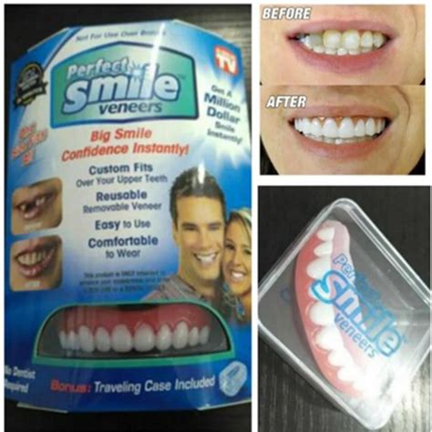 Perfect Smile Veneers Denture Paste Instant Teeth Flex Fit Press On ...