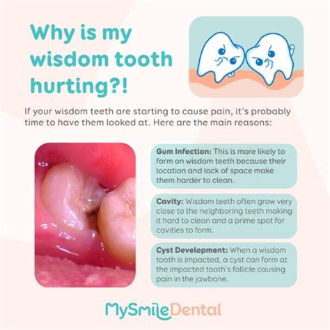 Wisdom teeth pain? - MySmile Dental Clinic