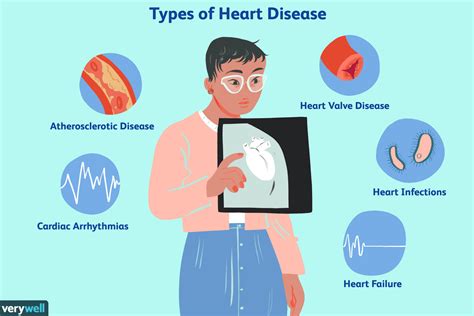 Heart Disease: Symptoms, Risk Factors Treatment, 42% OFF