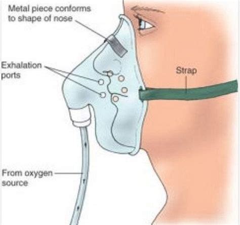 Non-rebreather mask Vs Partial rebreather mask Vs Simple mask | Simple face, Nurse study notes ...