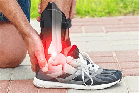 How to prepare for ankle surgery - Orthopedic Surgeon Monmouth County NJ | Marshall P. Allegra, M.D.