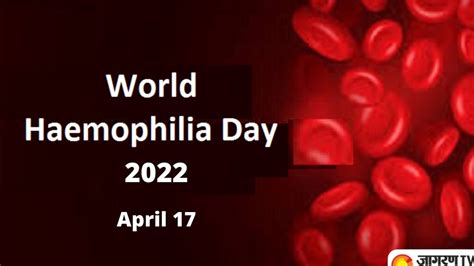 World Haemophilia Day 2022: Theme, History, Significance, Symptoms and more