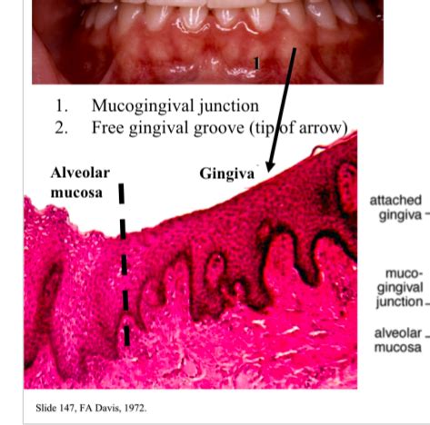 Mucogingival Junction Histology