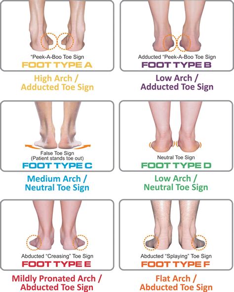 Sunfeet: Jenis Tapak Kaki Punca Sakit Kaki, Badan dan Pinggang