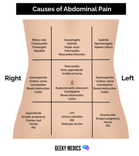 Causes Of Upper Abdominal Pain – NBKomputer