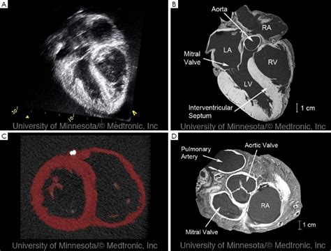 Ultrasound of the heart - what is it, how is the diagnostic | Health Care "Qsota" - Tips and ...