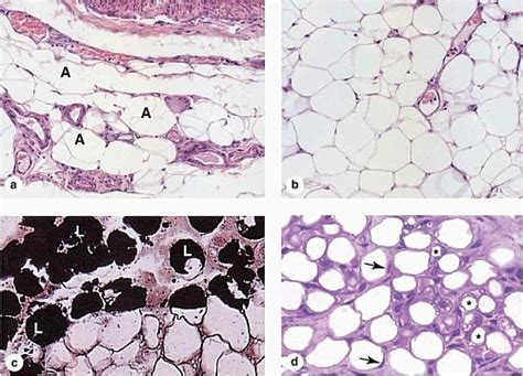 Adipose Tissue Labeled - Labeled Tissues Flashcards Quizlet, Check ...