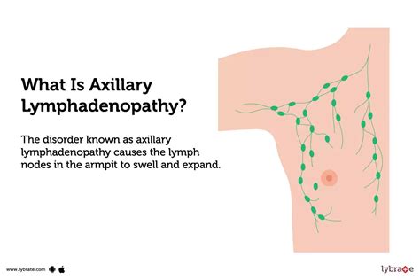 Axillary Lymph Nodes