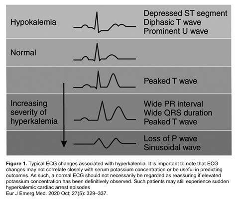 Hyperkalemia Revisited Recapem | The Best Porn Website