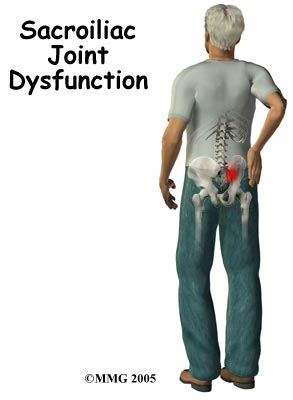 Causes Of Sacrum Pain