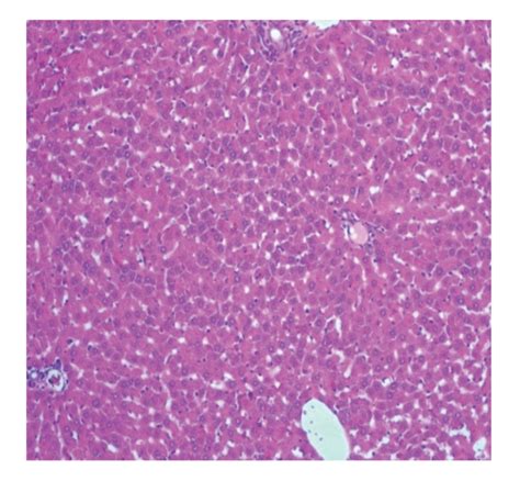 Section of the liver tissue of control group showing normal histology... | Download Scientific ...