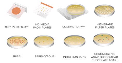 How To Count Bacteria On Agar Plates