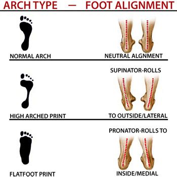 Pioneer Podiatry - Flat Feet, Collapsing Arches, Over-Pronation & High Arches