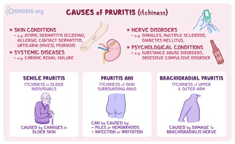 Pruritus: What Is It, Causes, Types, Treatment, and More | Osmosis