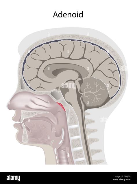 Human adenoid hi-res stock photography and images - Alamy