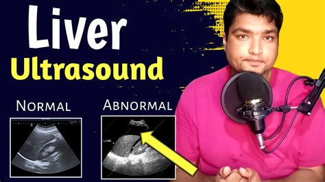 Liver Ultrasound Normal vs Abnormal | Liver Ultrasound Pathology | Liver Cirrhosis Ultrasound ...