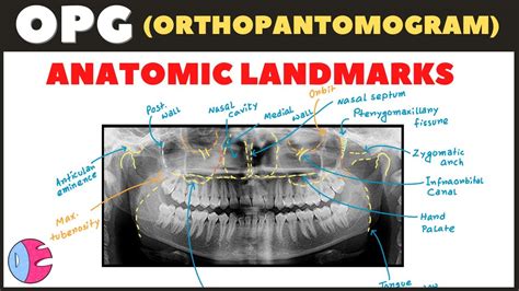 Orthopantomogram Opg